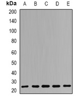 RPS7 Rabbit Polyclonal Antibody
