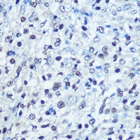 SAMHD1 Rabbit Polyclonal Antibody