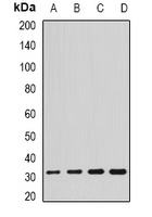 SCO2 Rabbit Polyclonal Antibody