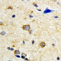 SCO2 Rabbit Polyclonal Antibody