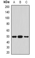 Serpin A4 Rabbit Polyclonal Antibody