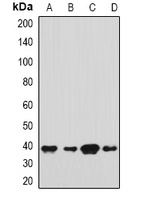 SH3GL2 Rabbit Polyclonal Antibody