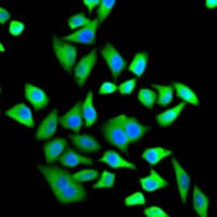 SH3GL2 Rabbit Polyclonal Antibody