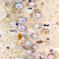 Sigma1 Receptor Rabbit Polyclonal Antibody