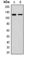 SIRT1 Rabbit Polyclonal Antibody