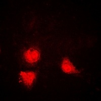 SIRT1 Rabbit Polyclonal Antibody