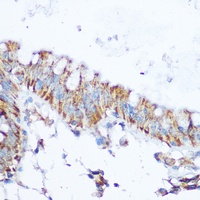 SIRT4 Rabbit Polyclonal Antibody