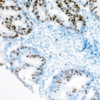 BRG1 Rabbit Polyclonal Antibody