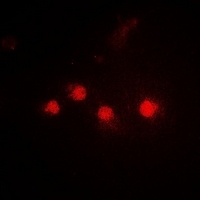 SMARCAD1 Rabbit Polyclonal Antibody