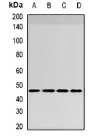 INI1 Rabbit Polyclonal Antibody