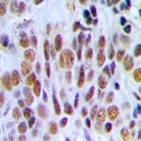 INI1 Rabbit Polyclonal Antibody