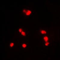 INI1 Rabbit Polyclonal Antibody