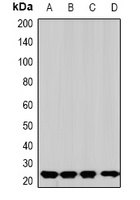 SOD2 Rabbit Polyclonal Antibody