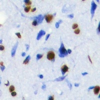 SOX2 Rabbit Polyclonal Antibody