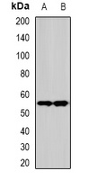 SPHK1 Rabbit Polyclonal Antibody