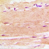 SPHK1 Rabbit Polyclonal Antibody