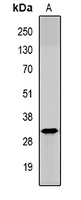 HAI-2 Rabbit Polyclonal Antibody