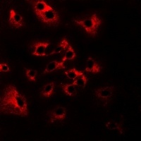 HAI-2 Rabbit Polyclonal Antibody