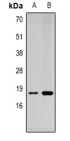 SUMO4 Antibody