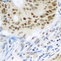 SUMO4 Antibody