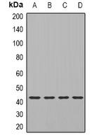 TIA1 Rabbit Polyclonal Antibody