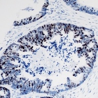 TIA1 Rabbit Polyclonal Antibody