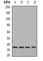 TIRAP Rabbit Polyclonal Antibody