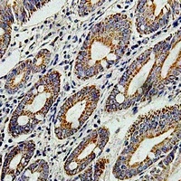 TNNC2 Rabbit Polyclonal Antibody