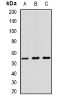 RNF81 Rabbit Polyclonal Antibody