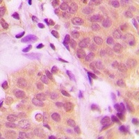 RNF81 Rabbit Polyclonal Antibody