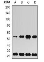 UBE2H Antibody