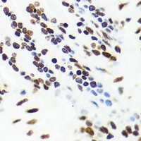 VRK1 Rabbit Polyclonal Antibody