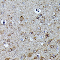 N-WASP Rabbit Polyclonal Antibody