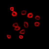 N-WASP Rabbit Polyclonal Antibody