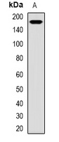 PRKWNK3 Rabbit Polyclonal Antibody
