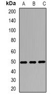 Wilms Tumor 1 Rabbit Polyclonal Antibody