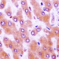 Wilms Tumor 1 Rabbit Polyclonal Antibody