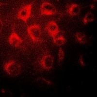 Wilms Tumor 1 Rabbit Polyclonal Antibody