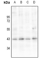 AT1 Rabbit Polyclonal Antibody