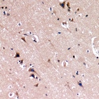 Nephrin Rabbit Polyclonal Antibody