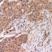 MYPT1 (Phospho-T696) Rabbit Polyclonal Antibody