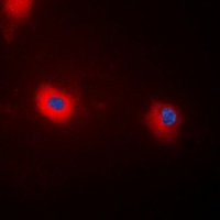 MYPT1 (Phospho-T696) Rabbit Polyclonal Antibody