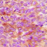 HSP20 (Phospho-S16) Rabbit Polyclonal Antibody