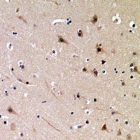 DDX3X (Phospho-T322) Rabbit Polyclonal Antibody