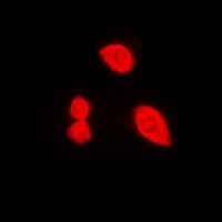 DDX3X (Phospho-T322) Rabbit Polyclonal Antibody