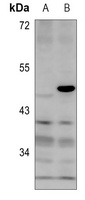 MKI67IP (Phospho-T234) Rabbit Polyclonal Antibody