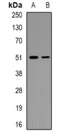 MNK1 (Phospho-T250) Rabbit Polyclonal Antibody