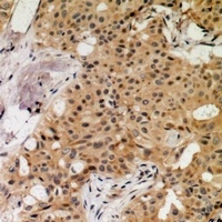 MNK1 (Phospho-T250) Rabbit Polyclonal Antibody