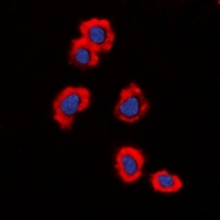 MUC1 Rabbit Polyclonal Antibody