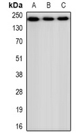 CHD4 Rabbit Polyclonal Antibody